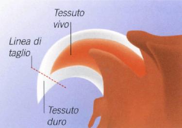 Cura delle unghie